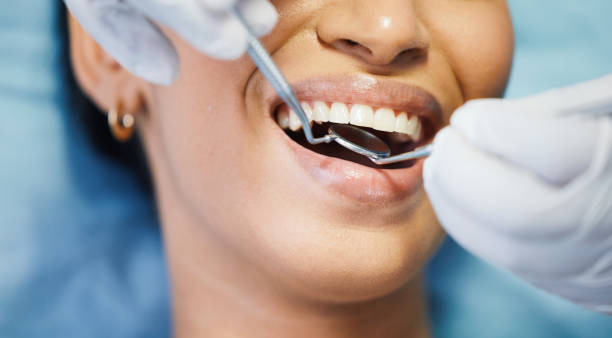 Best Emergency Tooth Extraction in North Barrington, IL