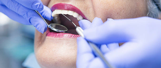 Best Urgent Care for Lost Fillings or Crowns in North Barrington, IL